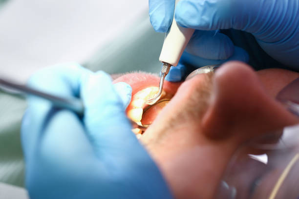 Best Emergency Broken Tooth Repair in Dolton, IL